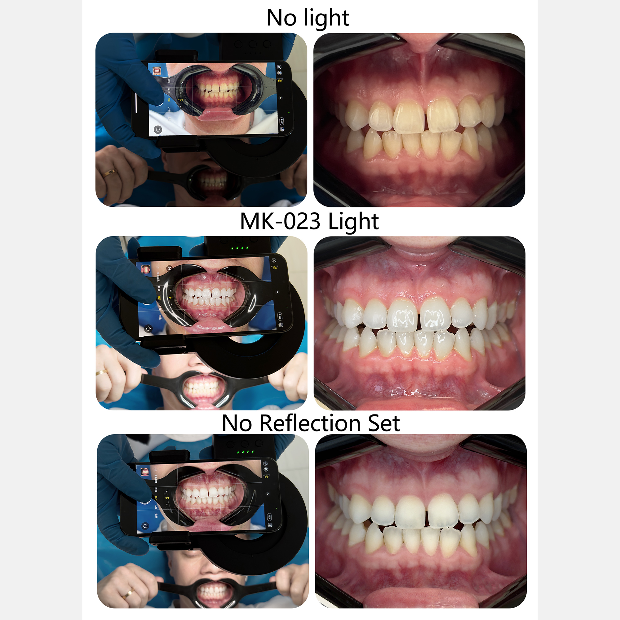 HERA MK-23 Intraoral Dental Ph – Photography Lighting Ring recenzja i cena